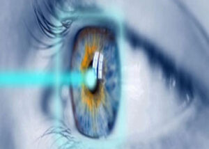 تصحيح النظر