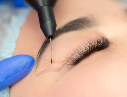 أفضل دكتور لتجميل العيون في مصر