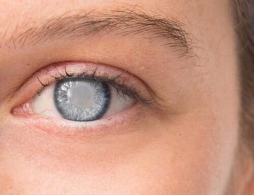 تكلفة عملية المياه البيضاء في العين