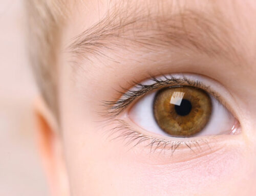 متلازمة بارديت – بيدل