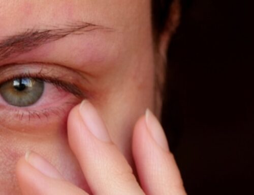 التِهاب العين